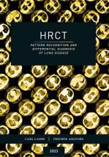 HRCT – pattern recognition and differential diagnosis of lung ...